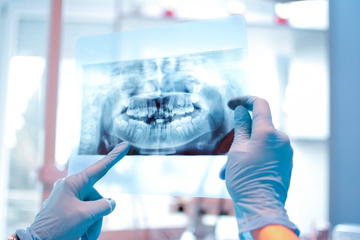 an orthodontic professional holding a patient's x-rays in the air to inspect them