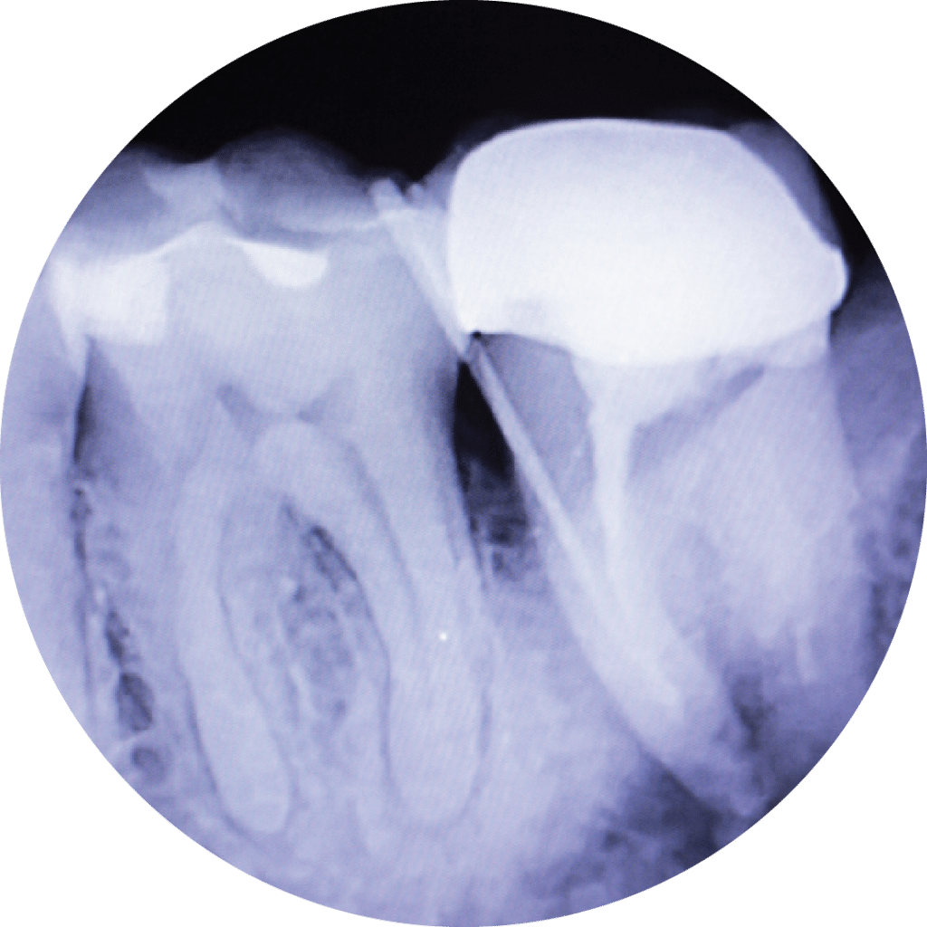digital dental x-rays for patients receiving orthodontic treatment