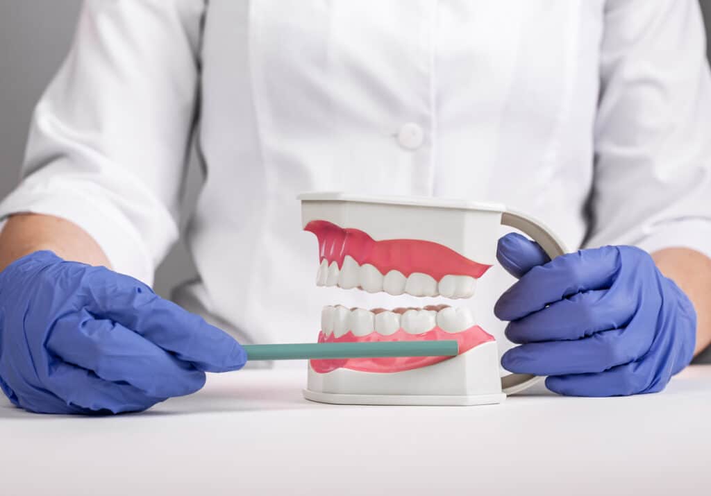Dental professional indicating wisdom teeth on a dental model