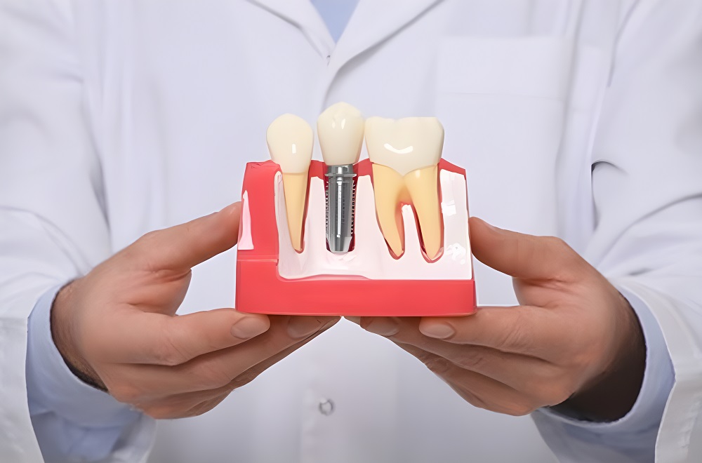 Dentist holds up educational implant model