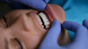 dentist examining veneers