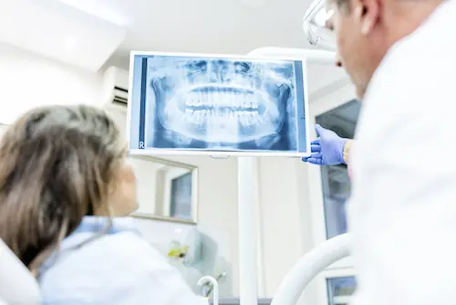 Digital Dental X-Rays available at Pathway Dental Group in Santa Barbara, CA