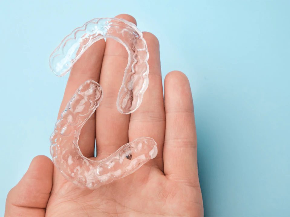 Dental retainers available at Pathway Dental Group in Santa Barbara, CA