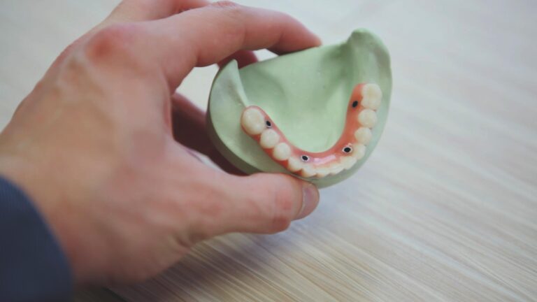 Hand holding a dental model of a lower jaw with artificial teeth and black markers or implants on the gum line.