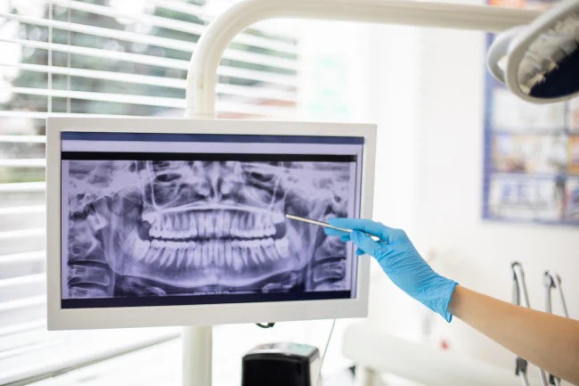 Digital Dental X-Rays available at Pathway Dental Group in Santa Barbara, CA