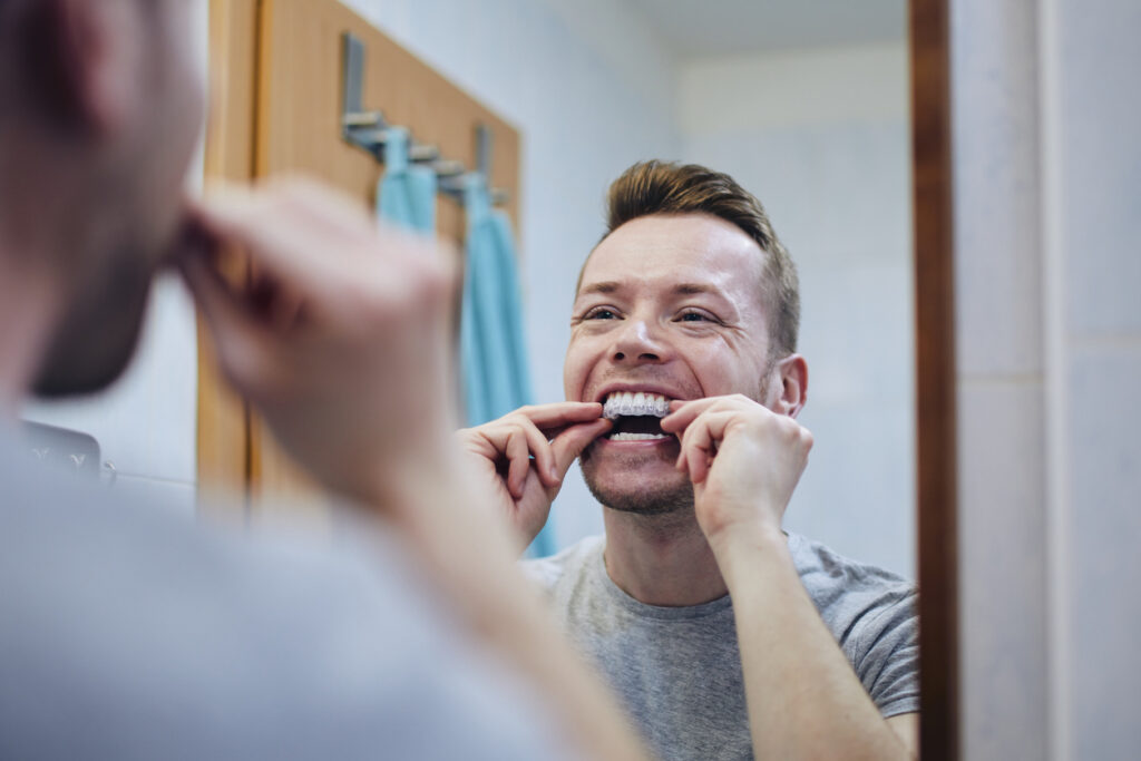 A man in the mirror preparing a silicone tray for teeth whitening.