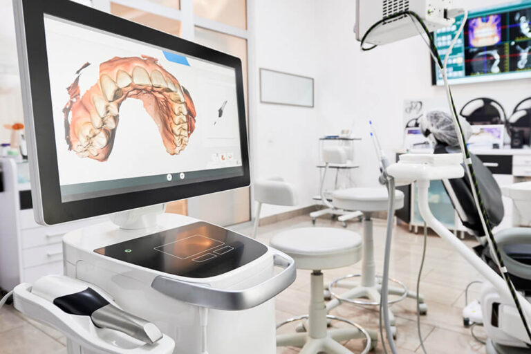 Chairside Economical Restorations of Esthetic Ceramic (CEREC) machine that is used at Pathway Dental Group