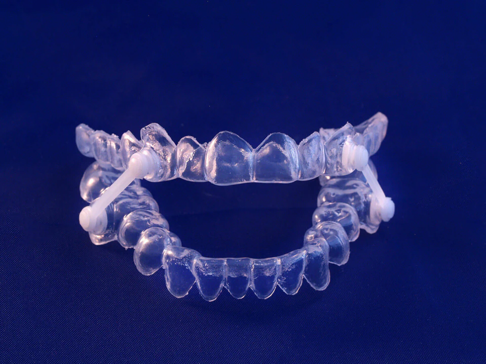 Sleep apnea dental appliances and sleep apnea treatment at Pathway Dental Group in Santa Barbara, CA
